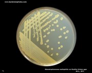 mueller hinton agar stenotrophomonas